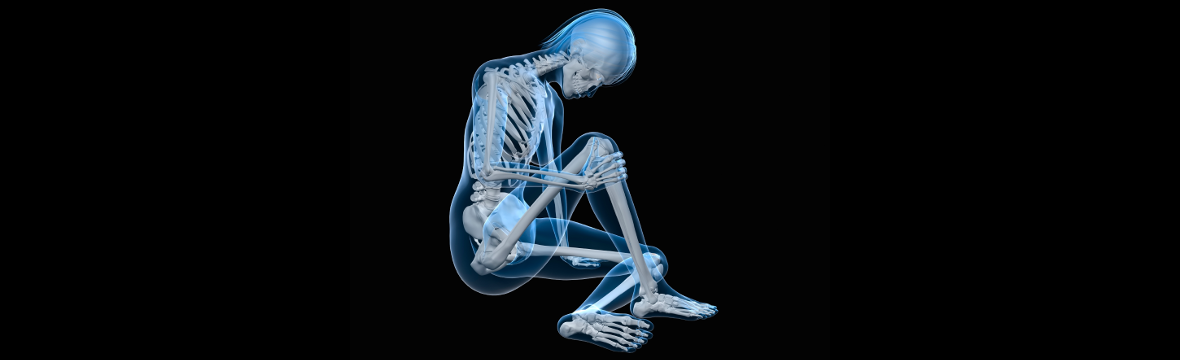 cáncer de hueso o sarcoma cáncer de hueso o sarcoma