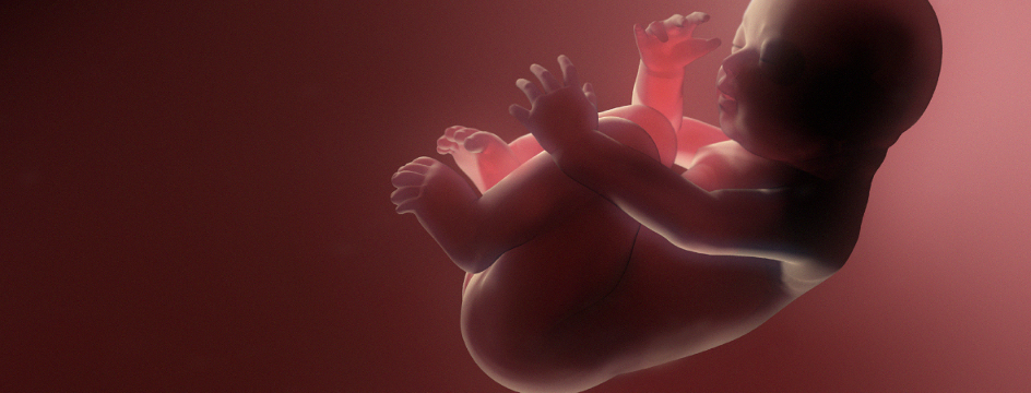 muerte fetal muerte fetal